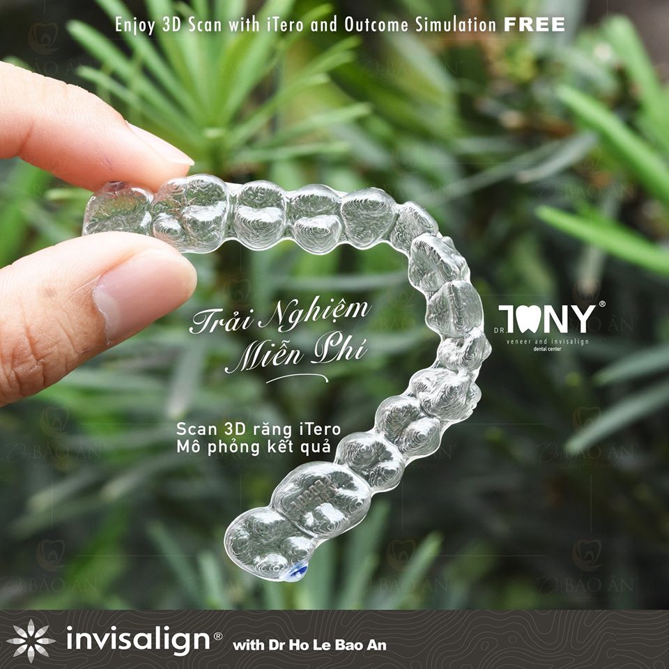 Niềng răng trong suốt Invisalign